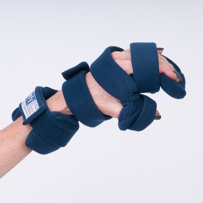Progressive Rest Hand Splint
